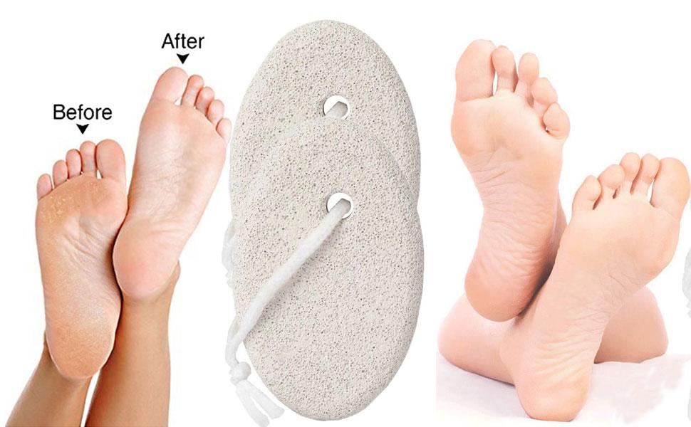 Pumice Stone for Feet