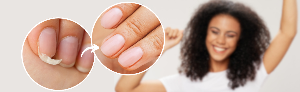 FROM FRAGILE TO STRONG AND HEALTHY NAILS