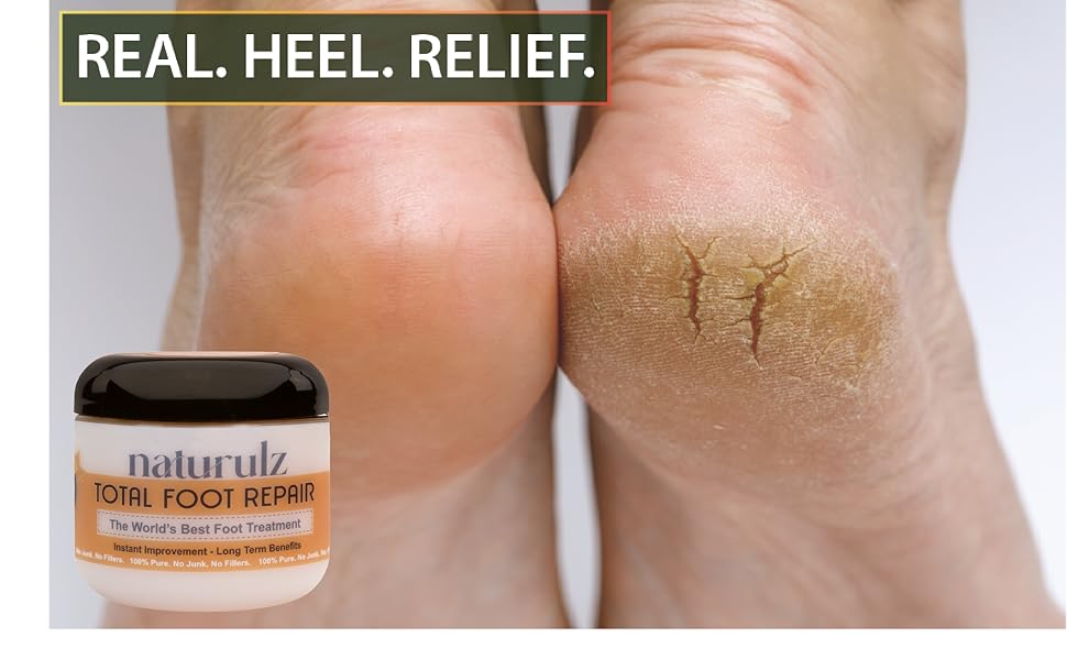 Real Heel Relief