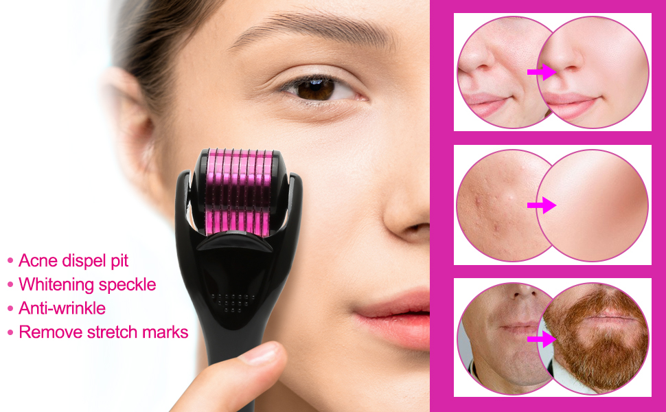 Derma Roller 1mm and 0.5mm, 2Pcs 540 Titanium Microneedling Rollers for