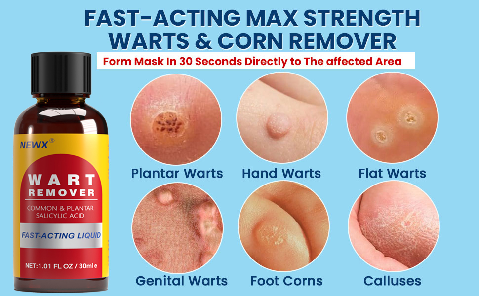 WART REMOVER FAST-ACTING