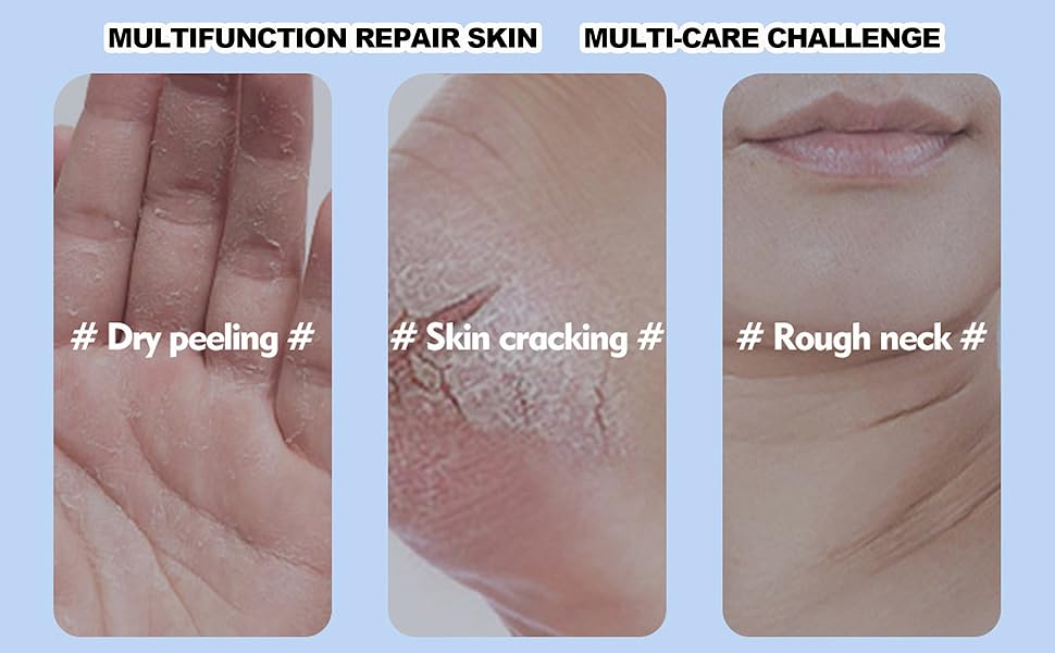 Foot Care Cream Cracked Feet