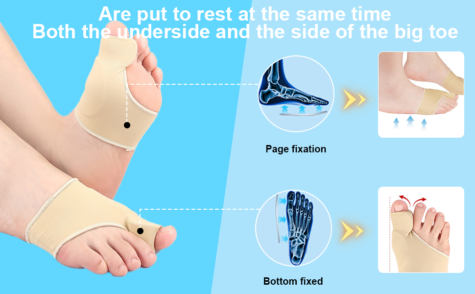 hallux valgus korrektur schiene socken bandage ballenzehen bunion corrector zehenspreizer