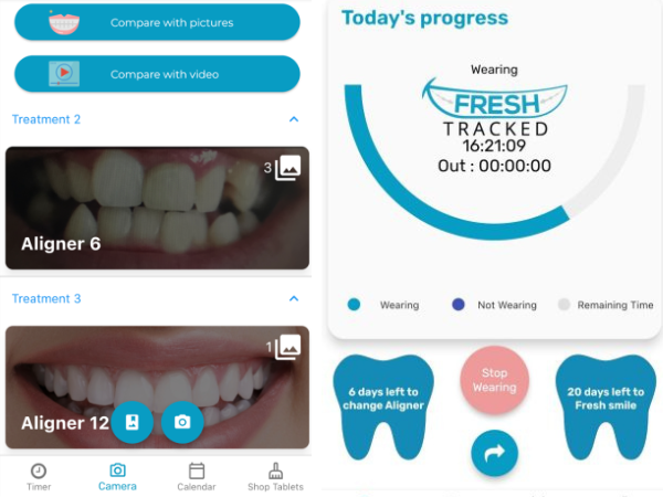 Dental aligner tracking app interface showing progress meter, treatment timeline, and comparison photos of teeth alignment progress