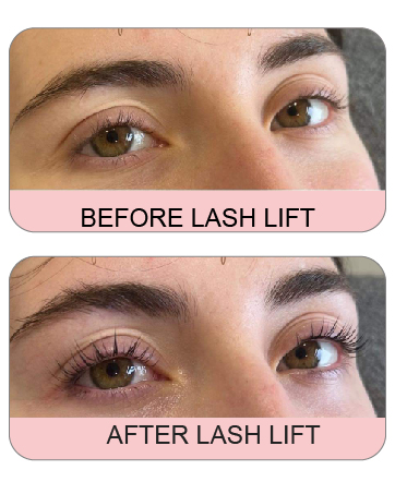 lash lift before and after
