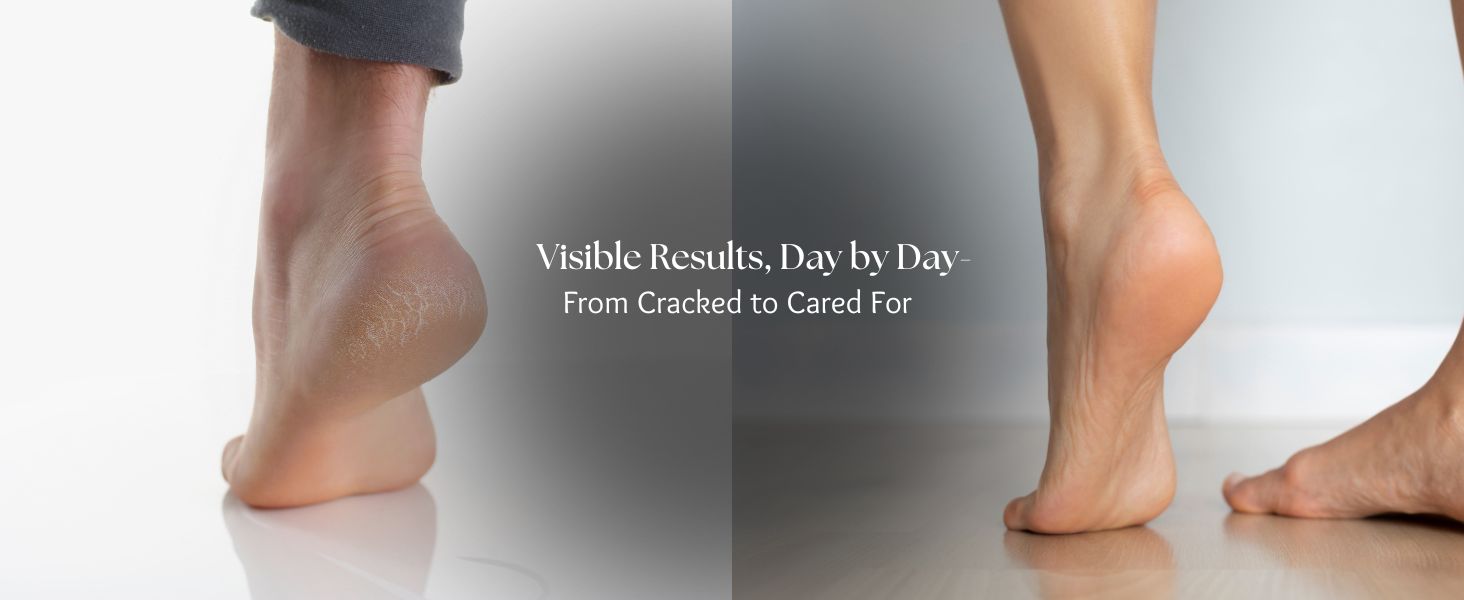 Results