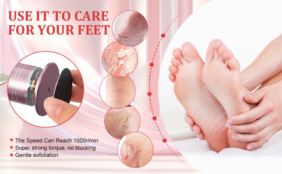 electric callus remover