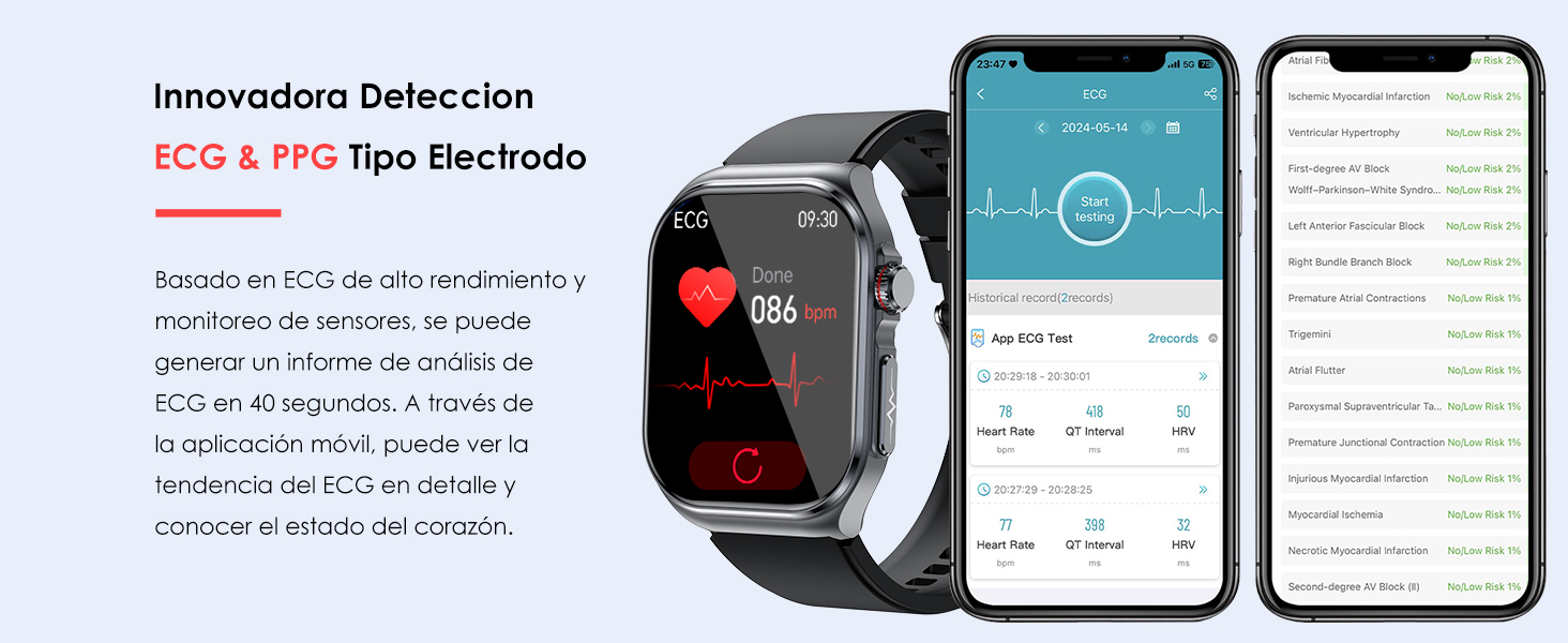 ecg smartwatch