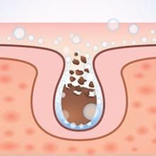 face steamer bottle   face steamer battery