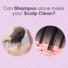 Scalp treatment for dry scalp