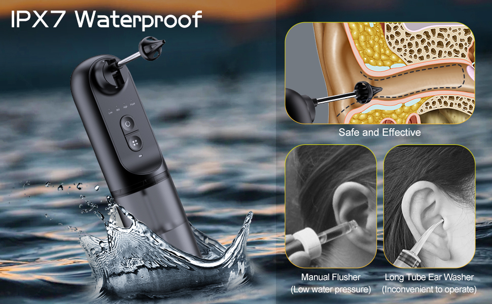 earwax removal kit