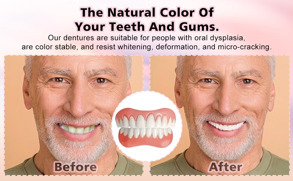 dentures for women