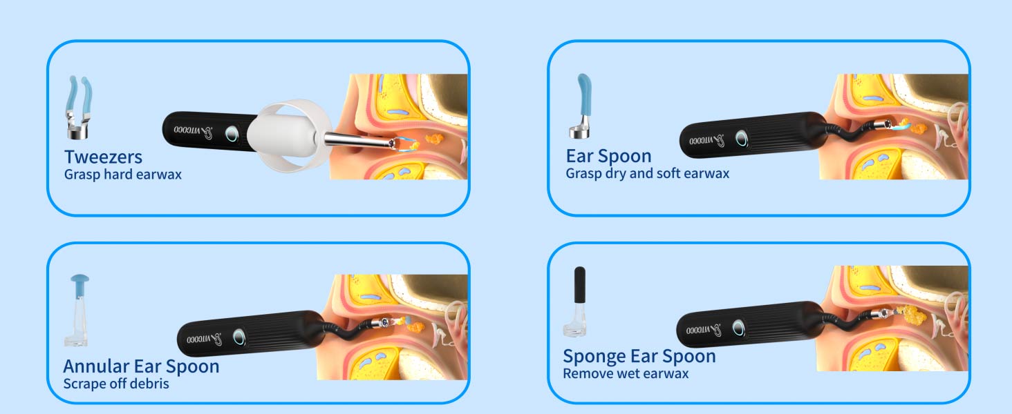 otoscope