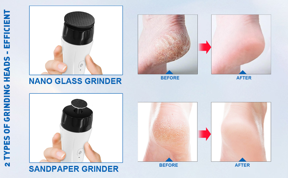 rechargeable foot callus remover