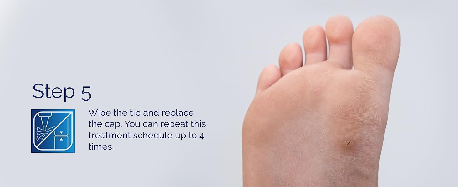 Scholl Verruca and Wart Complete Treatment Pen Amazon.co.uk Health