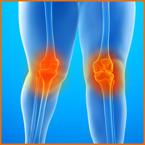 extra large knee brace
