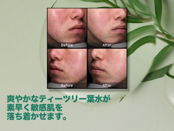 Amazon | SOME BY MI(サムバイミー) AHA.BHA.PHA 30デイズ