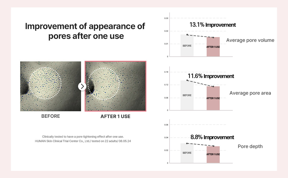 improvement of appearance of pores after one use