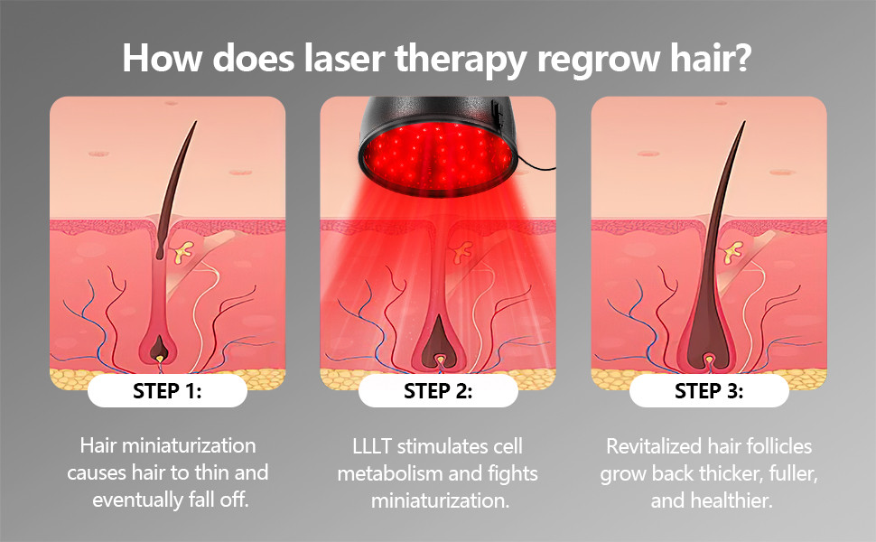 red light therapy for hair growth