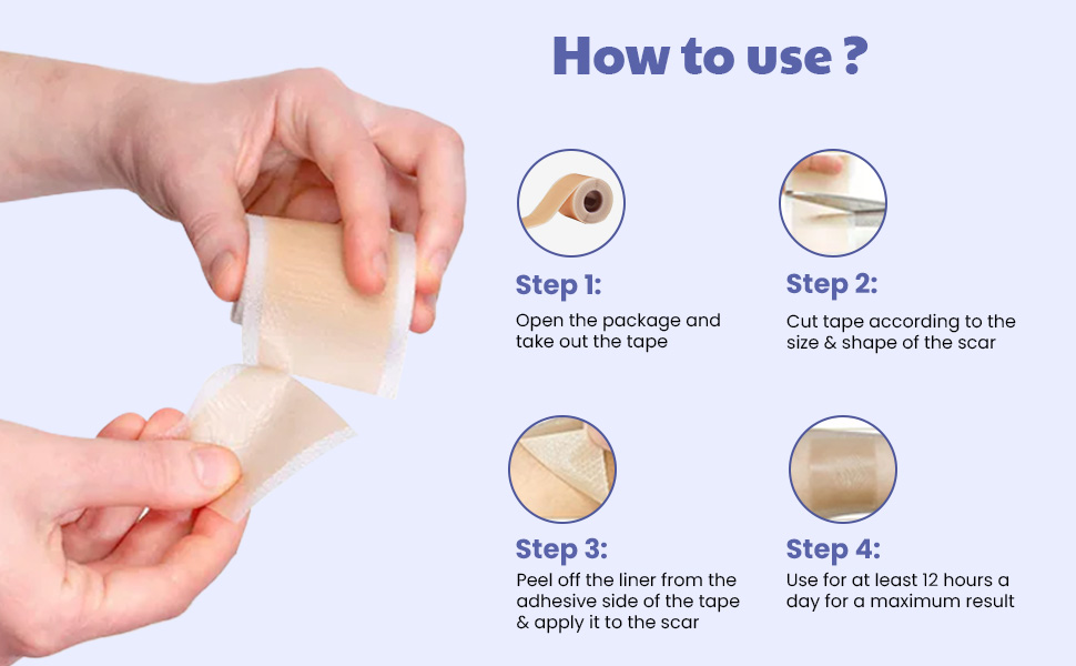 Wipness Silicone Scar Sheets