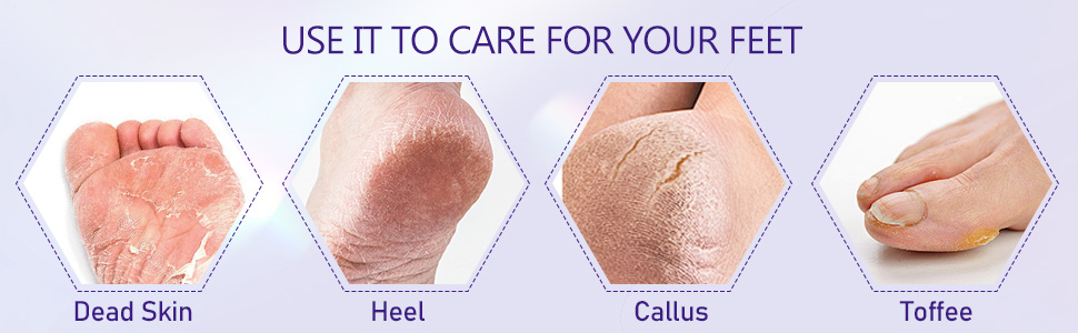 Electronic Foot File Grinder 