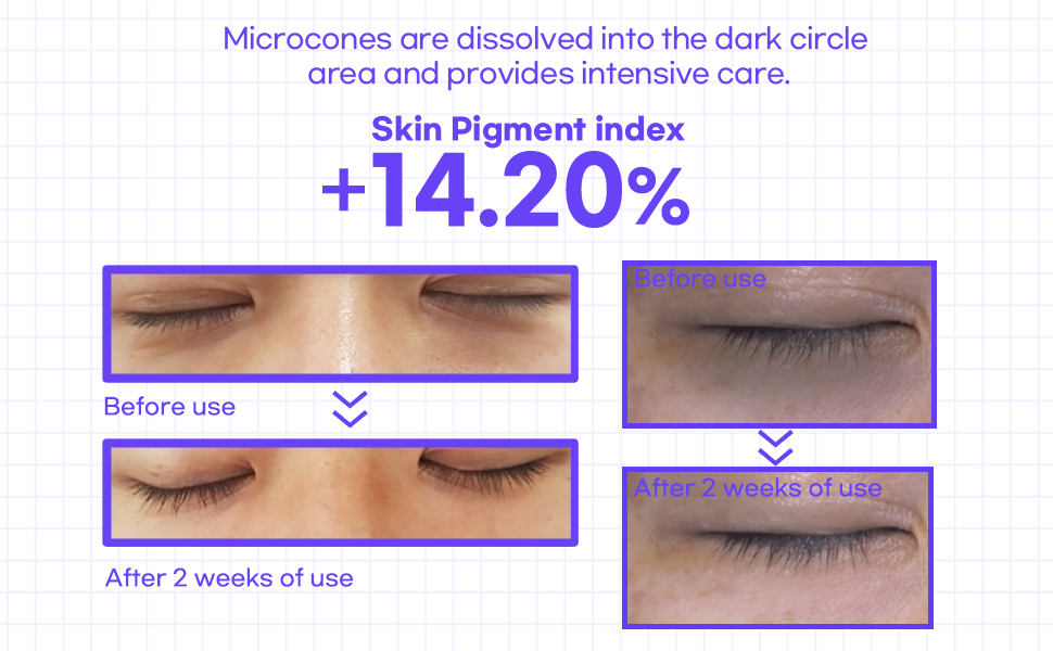 Clinical result of dark circle