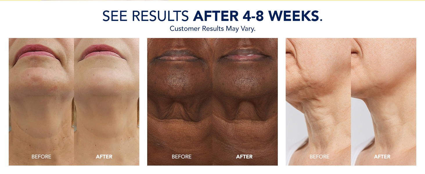 See results
