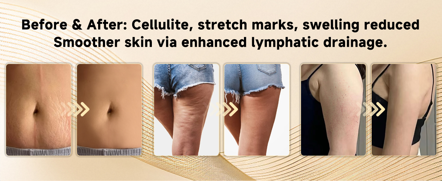 Lymphatic Drainage Massager