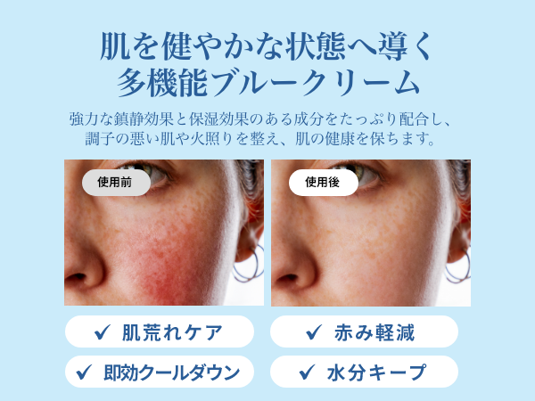 Amazon | 敏感肌 肌荒れ クリーム [クレアス (Klairs)] ミッドナイト