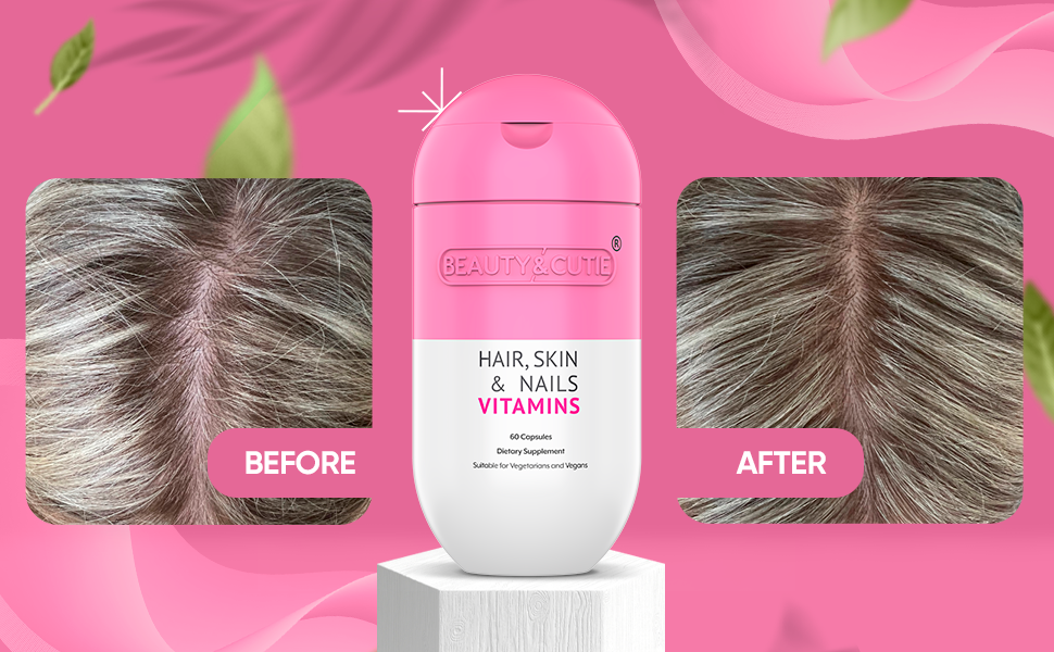 Before After vitamins supplements, hair skin nails