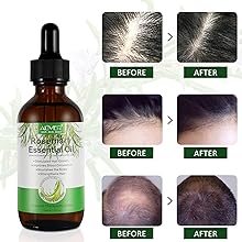 Rosemary oil can stimulate blood circulation in the scalp which helps grow healthier hair