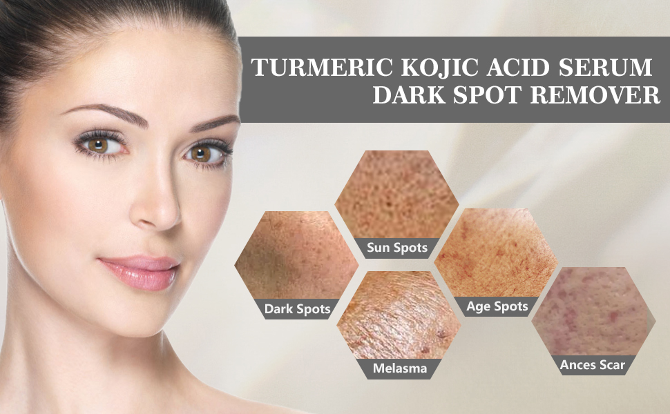  Dark Spot Remover Serum for Face and Body