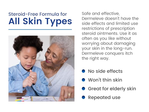 anti itch cream general audience good for scalp health