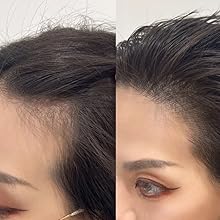 hairline