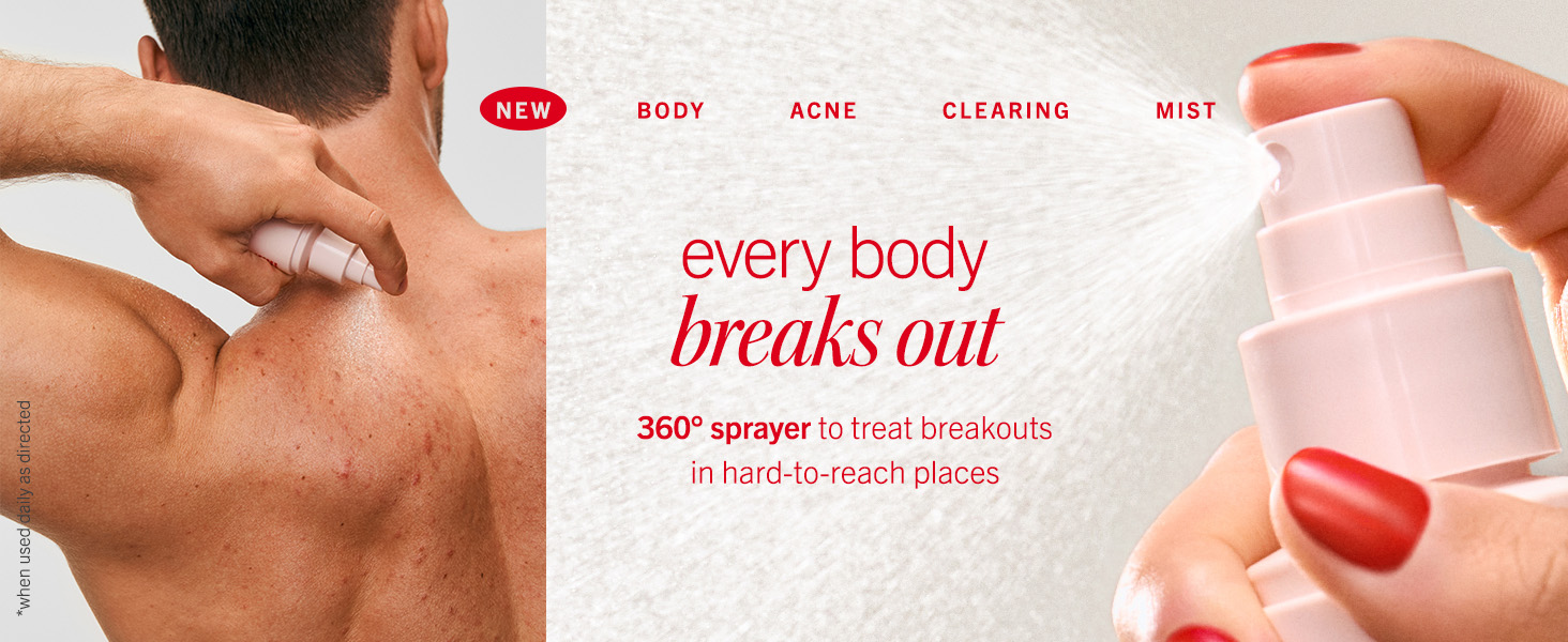 acne mist spray