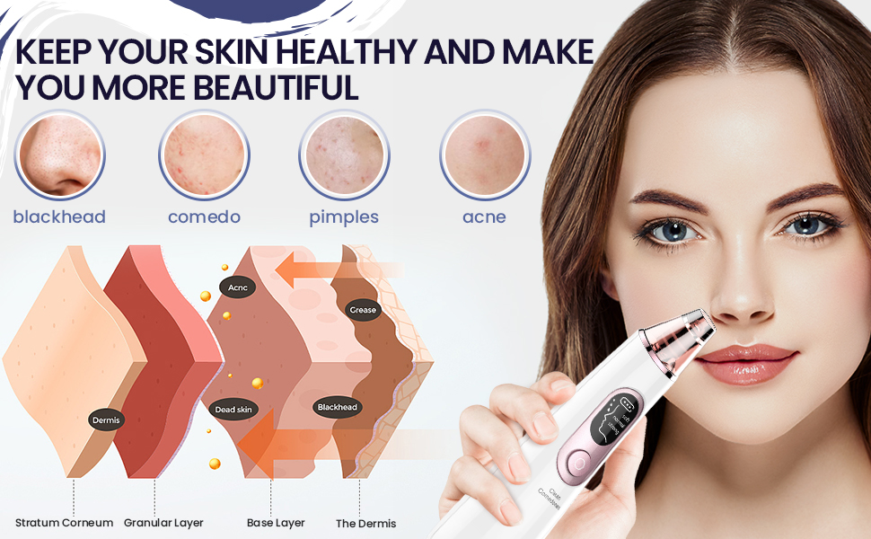 Blackhead Remover Pore Vacuum Acne Extractor Electric Face