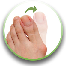 zehenspreizer silikon