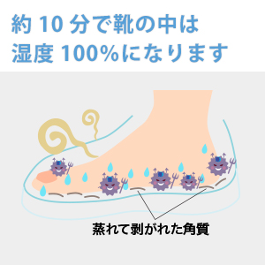 The shoes have a lot of exfoliating texture on the feet.