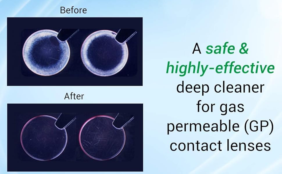 Menicon Progent 7 Treatment Biweekly Gas Permeable Contact