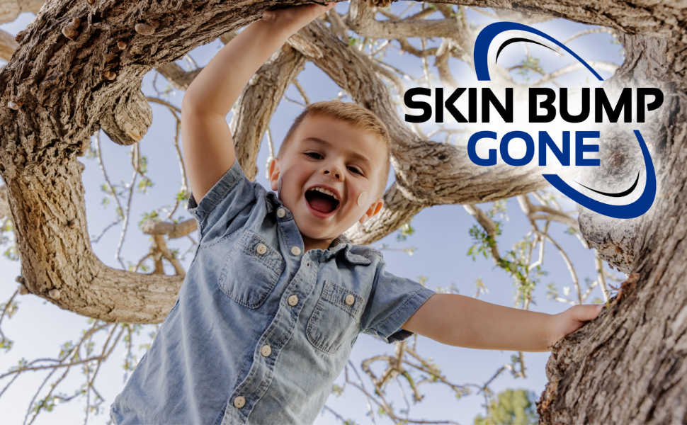 Skin Bump Gone