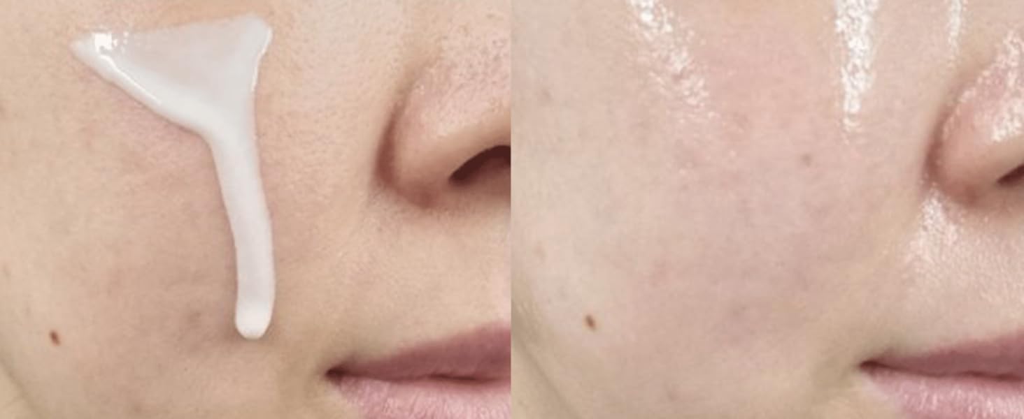Blanc Ampoule Before and After 1.1