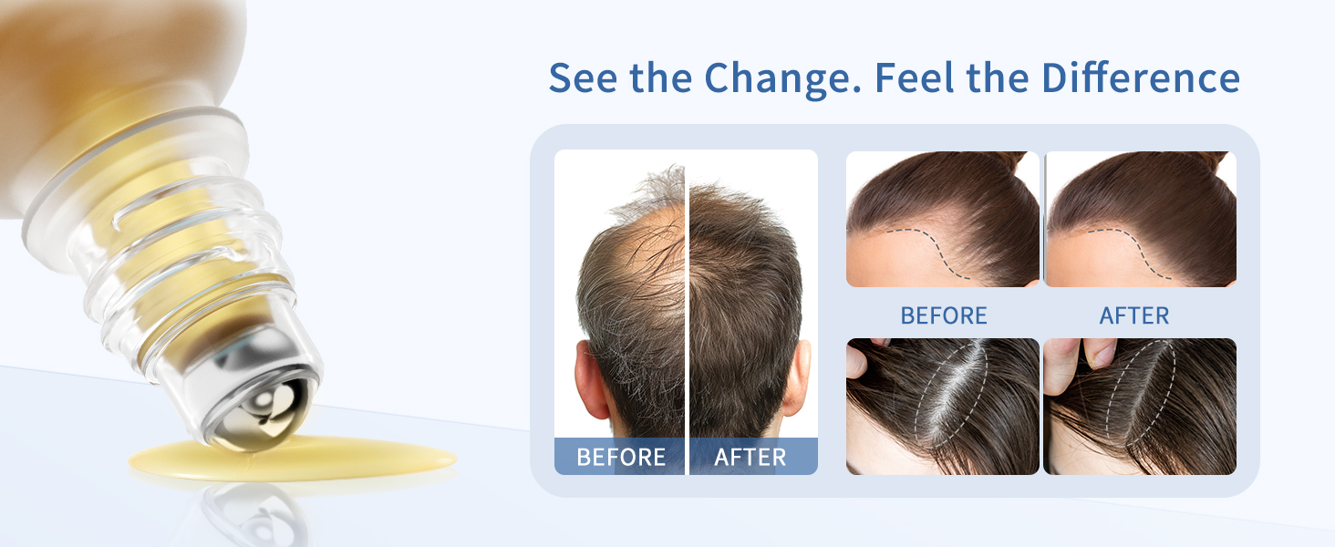 Hair growth roll on serum