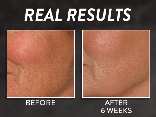 before and after peptide serum