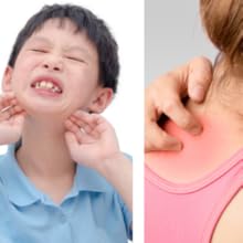 rashes
