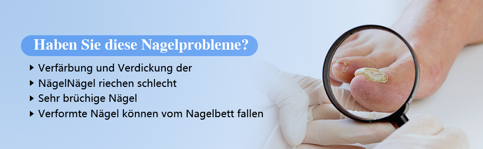 Haben Sie diese Nagelprobleme?