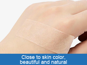 silicone scar sheets