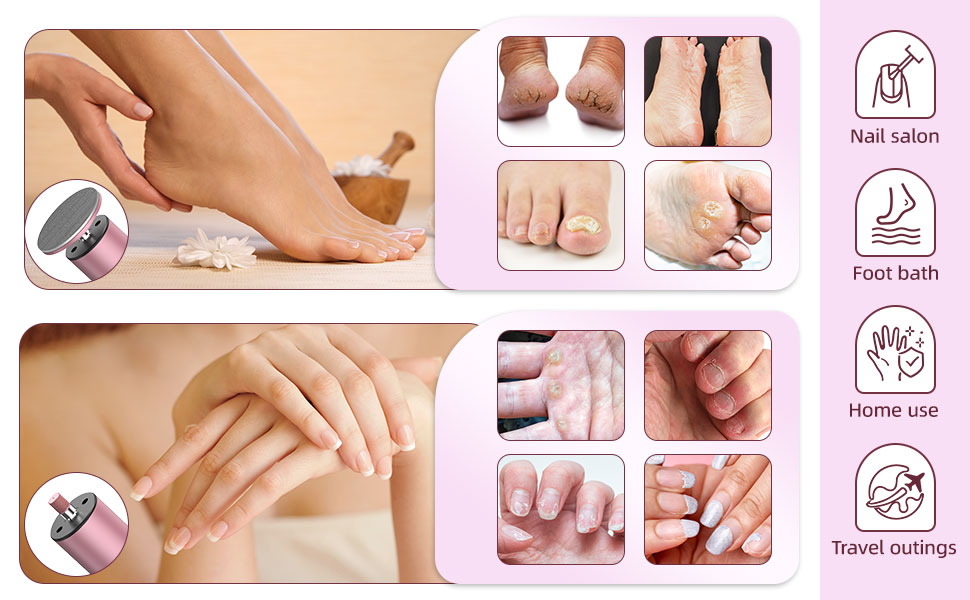 electric foot callus remover,electric callus remover for feet,electric foot file