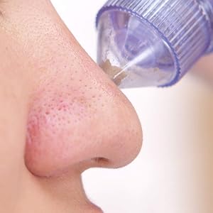 black head remover nose