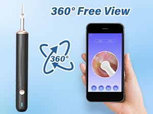 TopQuaFocus Electric Camera Earwax Removal Kit 1000P HD Otoscope