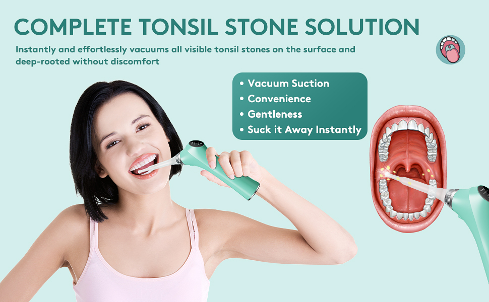 Electronic Vacuum Tonsil Stone Remover Tonsil Stone Removal Kit with Builtin LED Light & 3